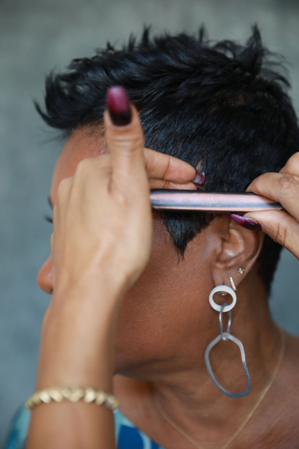 Profile study of a healthy hairline